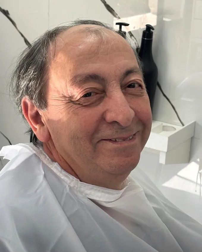 Cliente da Recriare Beleza antes da prótese capilar